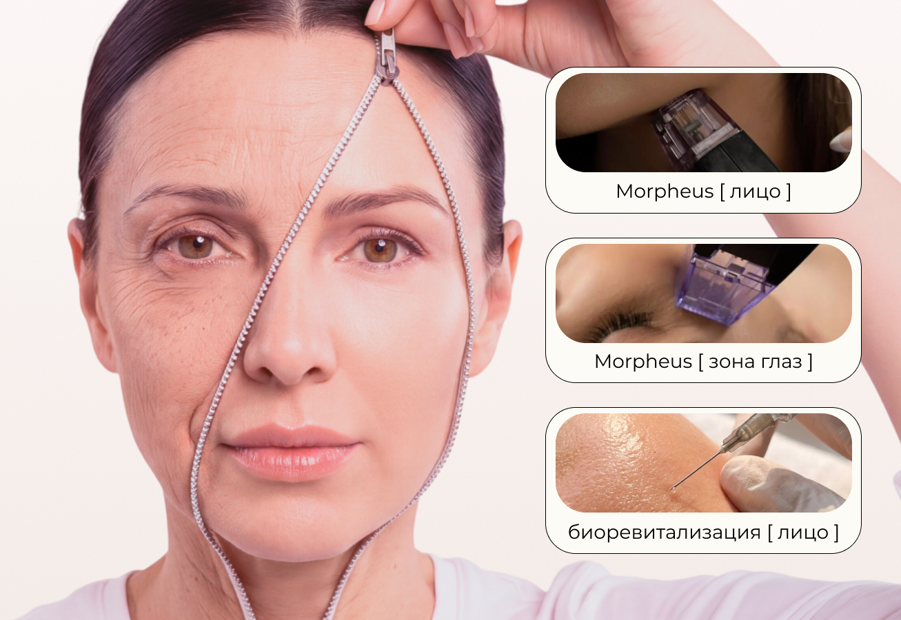 Комплексное омоложение Morpheus 8 + Bellarti Amino Plus — чёткие контуры и сияющая кожа