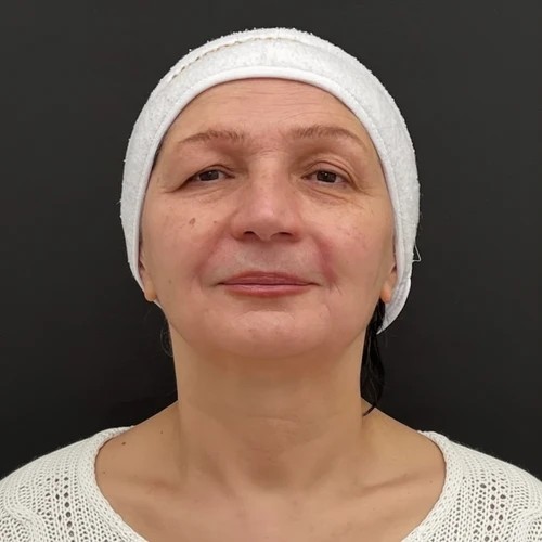 После