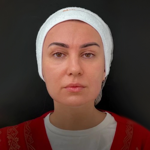 После